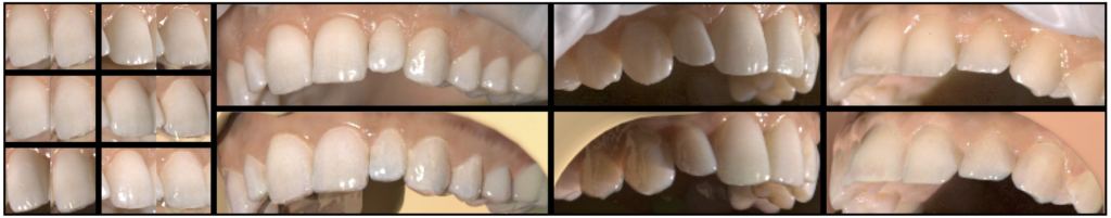 Appearance Capture and Modeling of Human Teeth - teaser